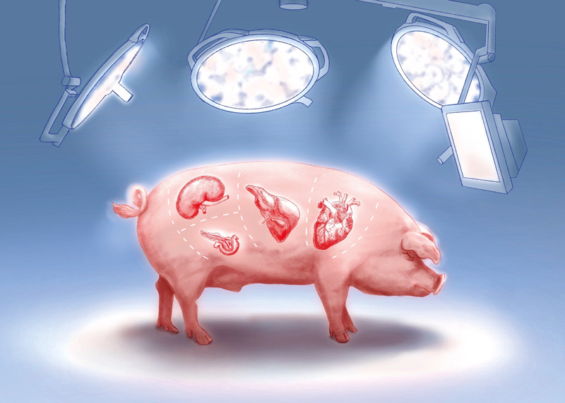 Illustration of a big under operating theatre lights